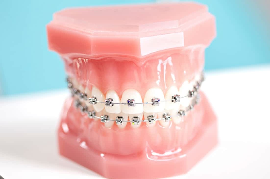 Orthodontic Dental Nursing